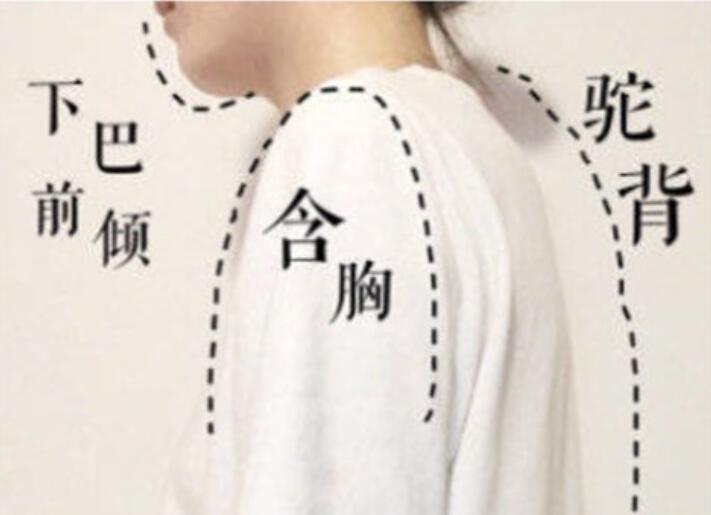 南寧美容學(xué)校：堅持一個月，駝背變直背