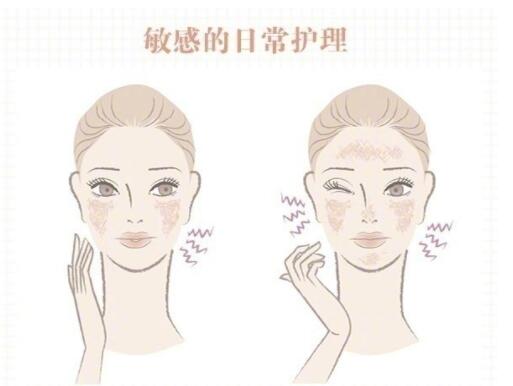 敏感肌保養(yǎng)大全！