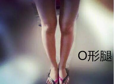 糾正你的腿型！