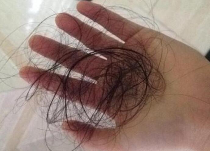 脫發(fā)女孩必備寶典！南寧美發(fā)學(xué)校教你