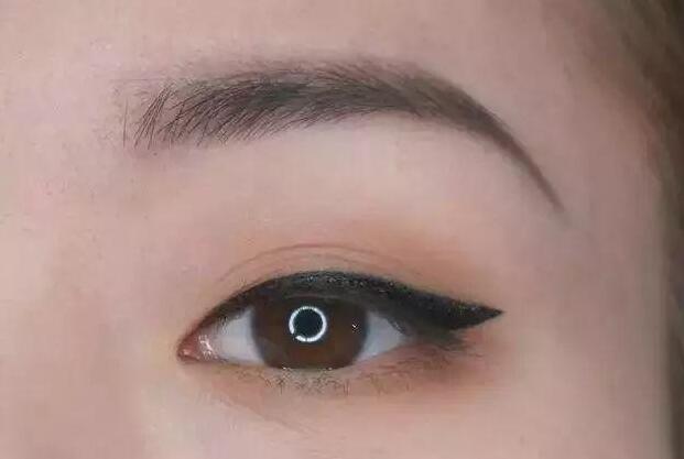 眼尾三角區(qū)怎么處理？