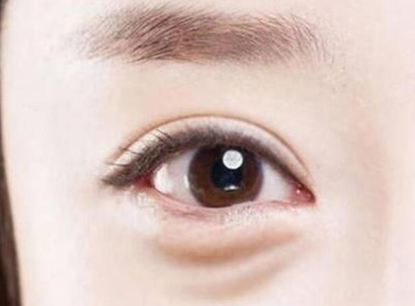 眼袋？淚溝？臥蠶？南寧美容學(xué)校教你辨別