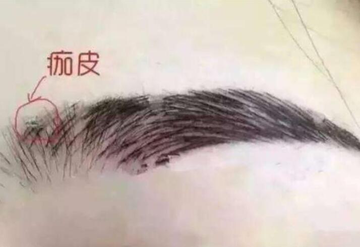 紋眉結(jié)痂時(shí)要注意什么？麗紋竹繡學(xué)校教你