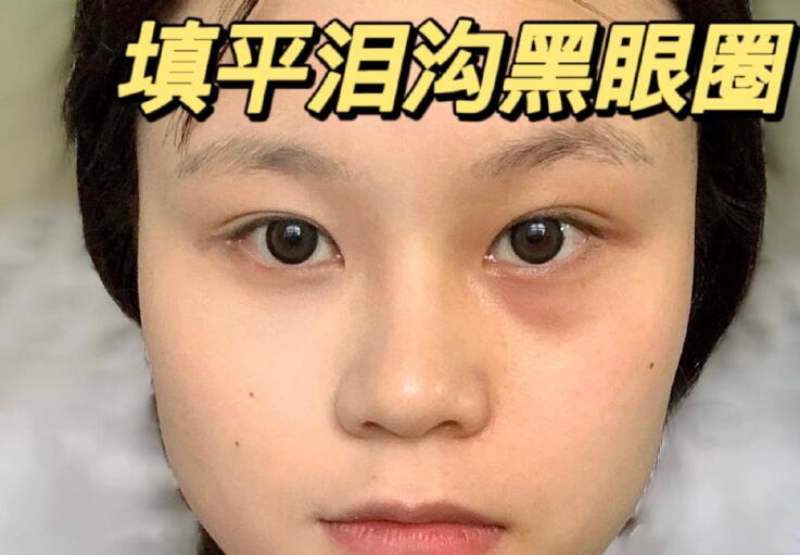 填平淚溝黑眼圈教程，廣西南寧化妝學(xué)校分享