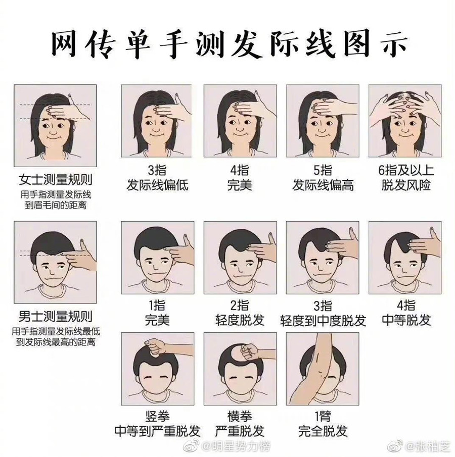 廣西頭療養(yǎng)發(fā)培訓(xùn)：單手測發(fā)際線教程