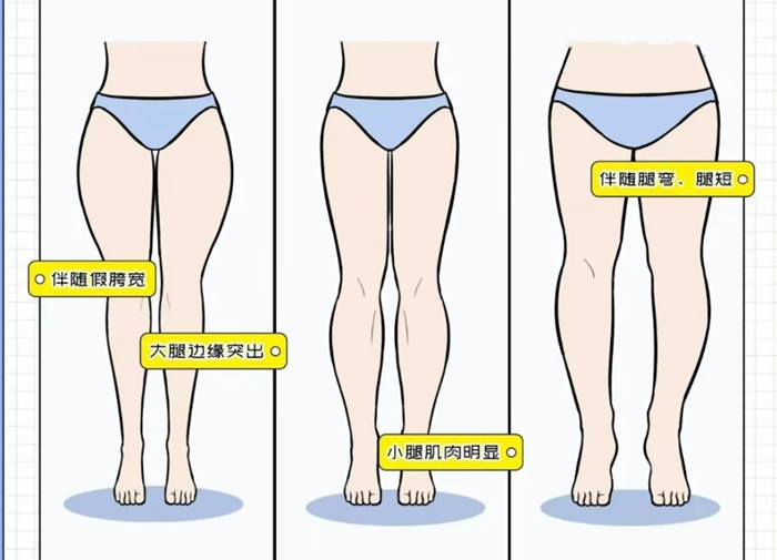 腿粗女生穿搭攻略，廣西彩妝造型搭配