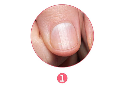 女生氣血不足六大表現(xiàn)，南寧美容養(yǎng)生資訊報(bào)道