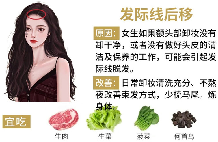 如何改善掉頭發(fā)？南寧頭療養(yǎng)發(fā)護(hù)發(fā)教學(xué)