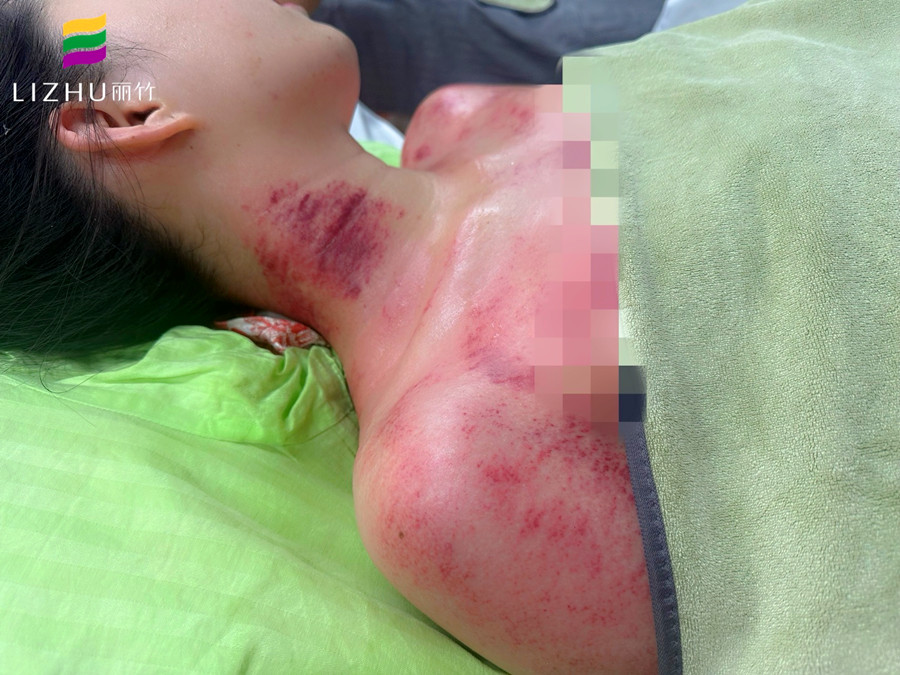 廣西學(xué)刮痧培訓(xùn)班 | 廣西學(xué)刮痧學(xué)費(fèi)多少？