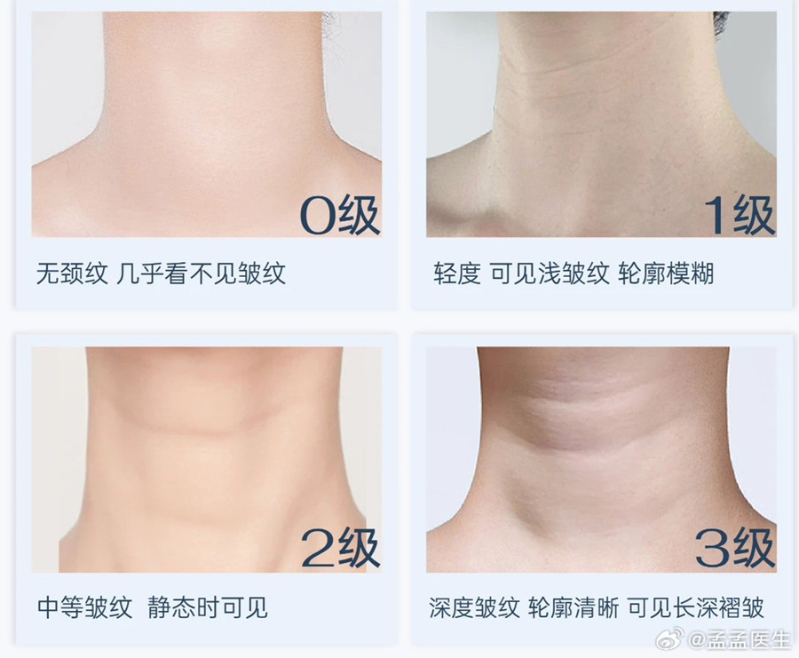 如何緩解頸紋？南寧美體美容管理培訓(xùn)