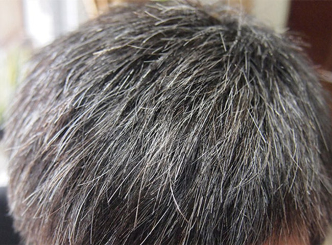 南寧美發(fā)基礎(chǔ)教學(xué)：為什么會(huì)長白頭發(fā)？